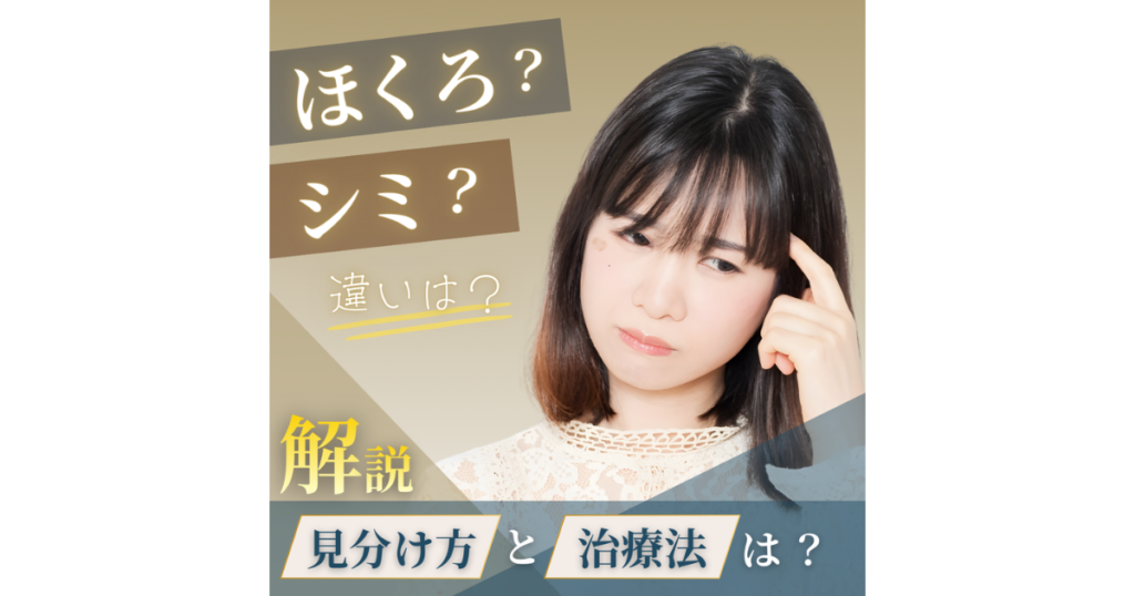 ほくろとシミの違いとは？見分け方から適切な治療法まで徹底解説