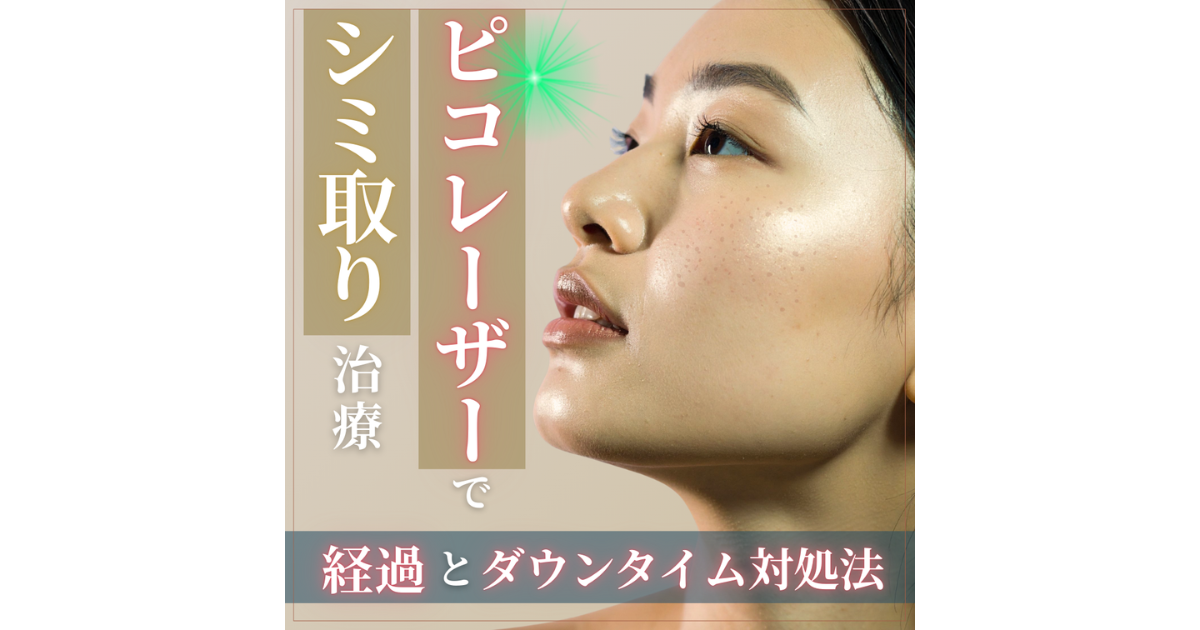 ピコレーザーシミ取り経過は？ダウンタイムの過ごし方も詳しく解説