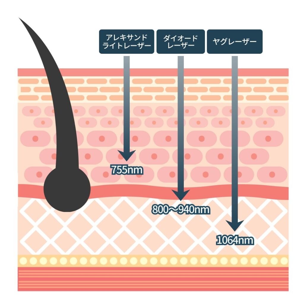 医療脱毛レーザーの波長と到達度を比較した図