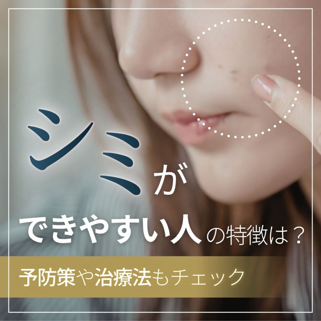 シミができやすい人の特徴は？今日からできる予防策や治療法も解説