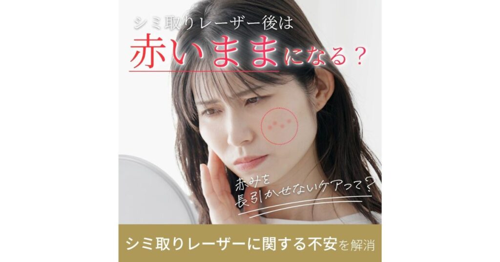 シミ取りレーザー後に肌が赤いままになるって本当？対策法や受診の目安を解説