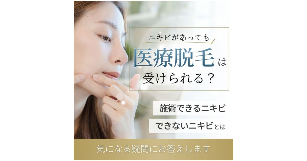 医療脱毛はニキビがあっても問題ない？施術のメリットや注意点を解説！