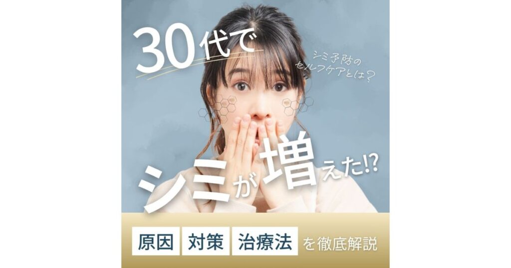 30代のシミは早期対策が大切!原因・セルフケア・治療法を解説
