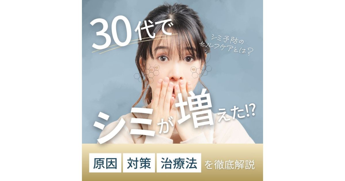 30代のシミは早期対策が大切！原因・セルフケア・治療法を解説