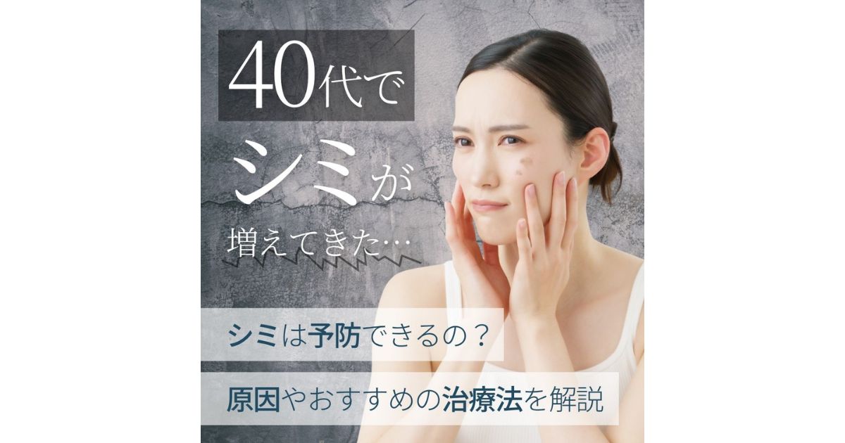 40代でシミが急に増えるのはなぜ？原因や予防策、治療法を解説